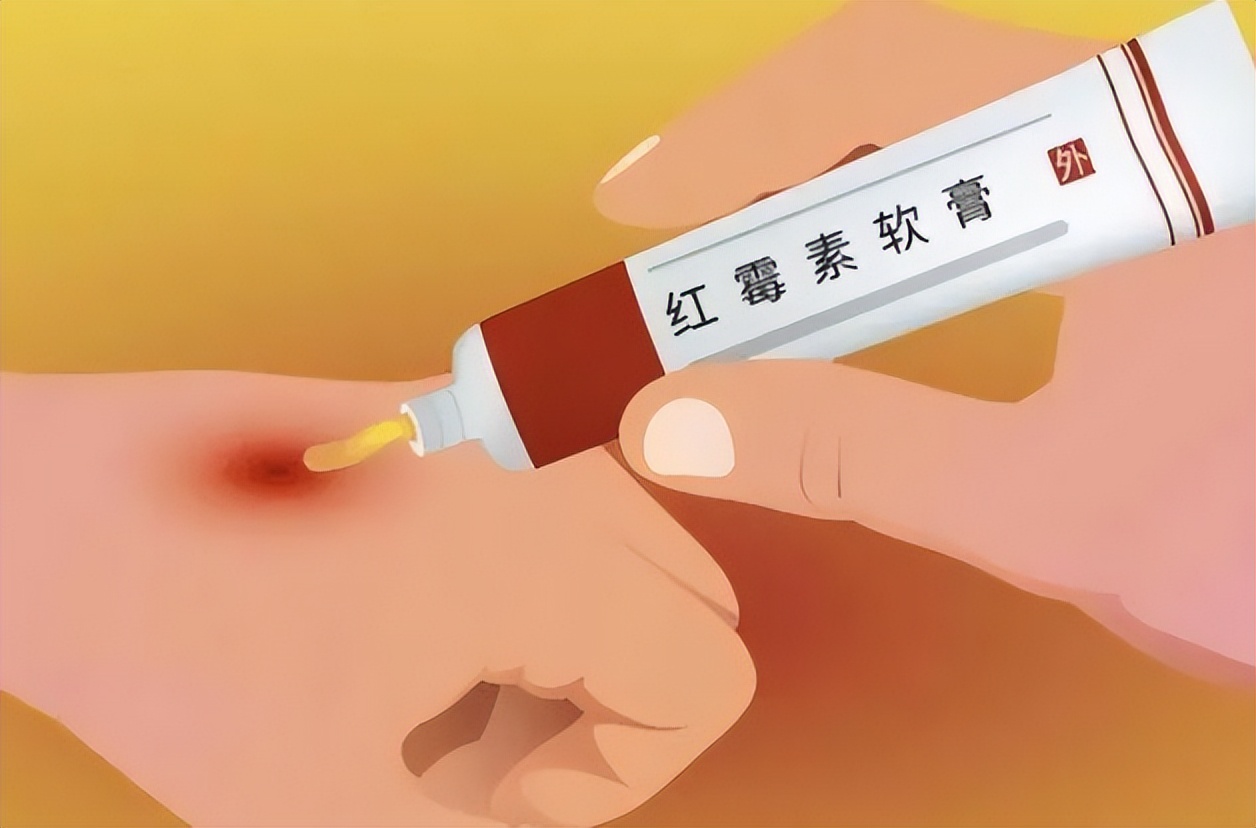 红霉素软膏的淡斑方法真实测评,红霉素软膏真有淡斑效果吗