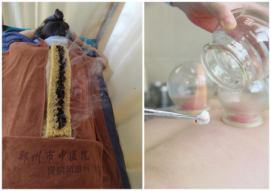 传统医学在现代医疗保健中的作用,传统中医康复技术与现代技术结合