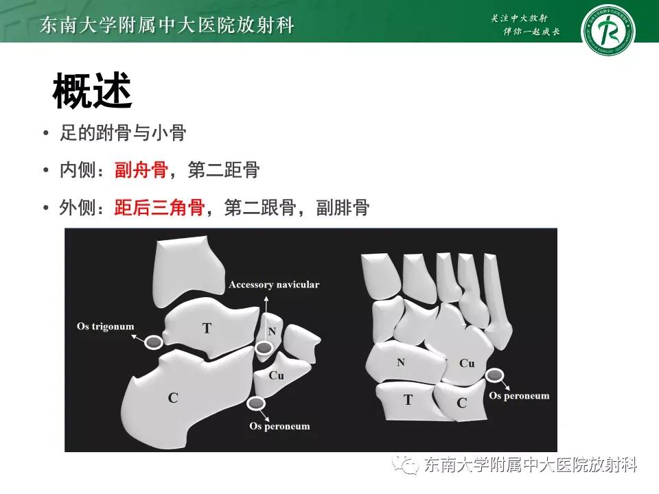 好文分享-《肌骨系统疾病——副舟骨综合征》
