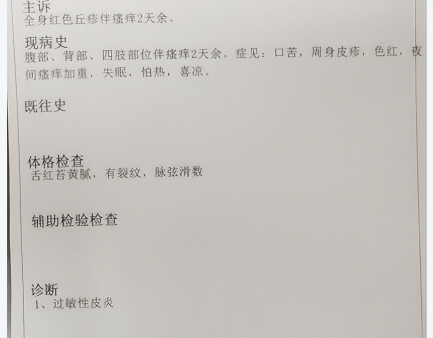 过敏性皮炎有什么症状和治疗,过敏性皮炎该怎么治疗最好