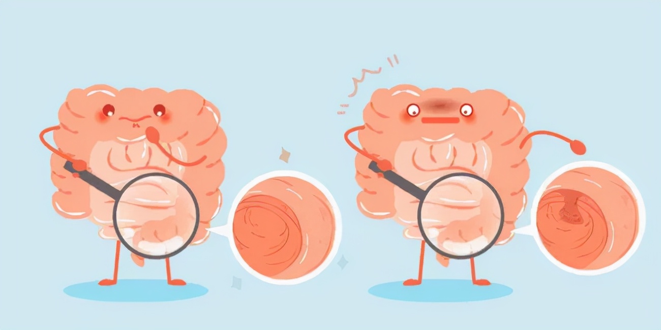 一个小息肉是什么,1毫米息肉会自己消失吗