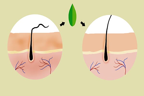 青春期头皮上长红疙瘩有头屑,头屑多头皮有小疙瘩怎么办