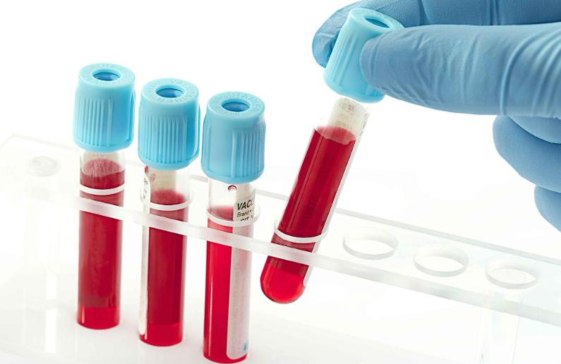 服用优甲乐后心慌具体表现,tsh值30多吃优甲乐一片一个月心慌