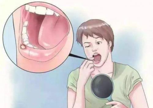 拉唑系列常用药有哪些,拉唑类的药都有什么