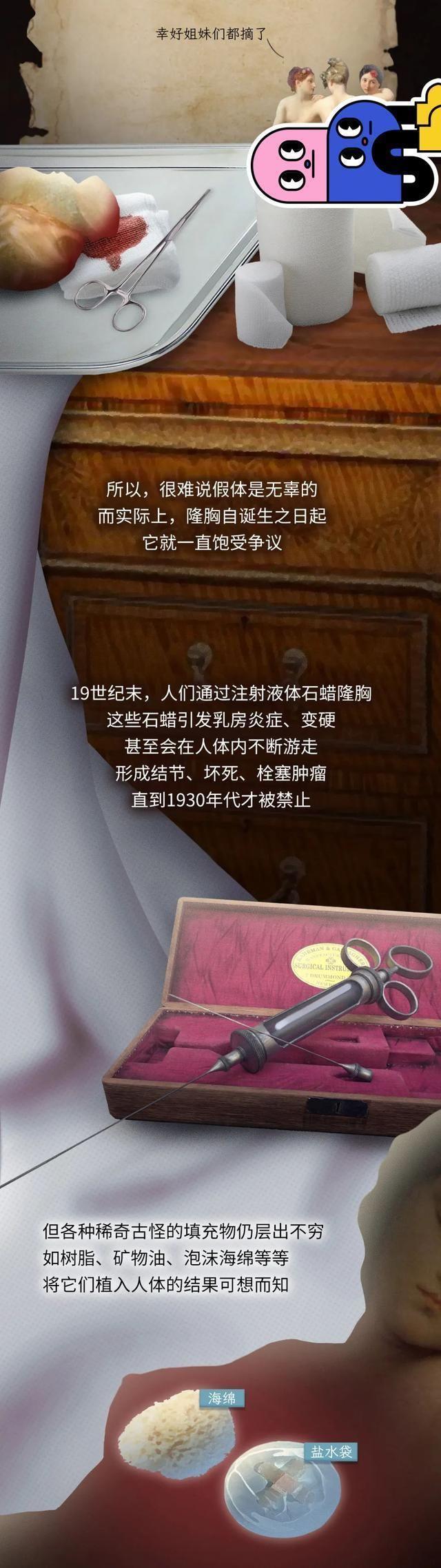 第一个隆胸的女人,第一个假体隆胸的人