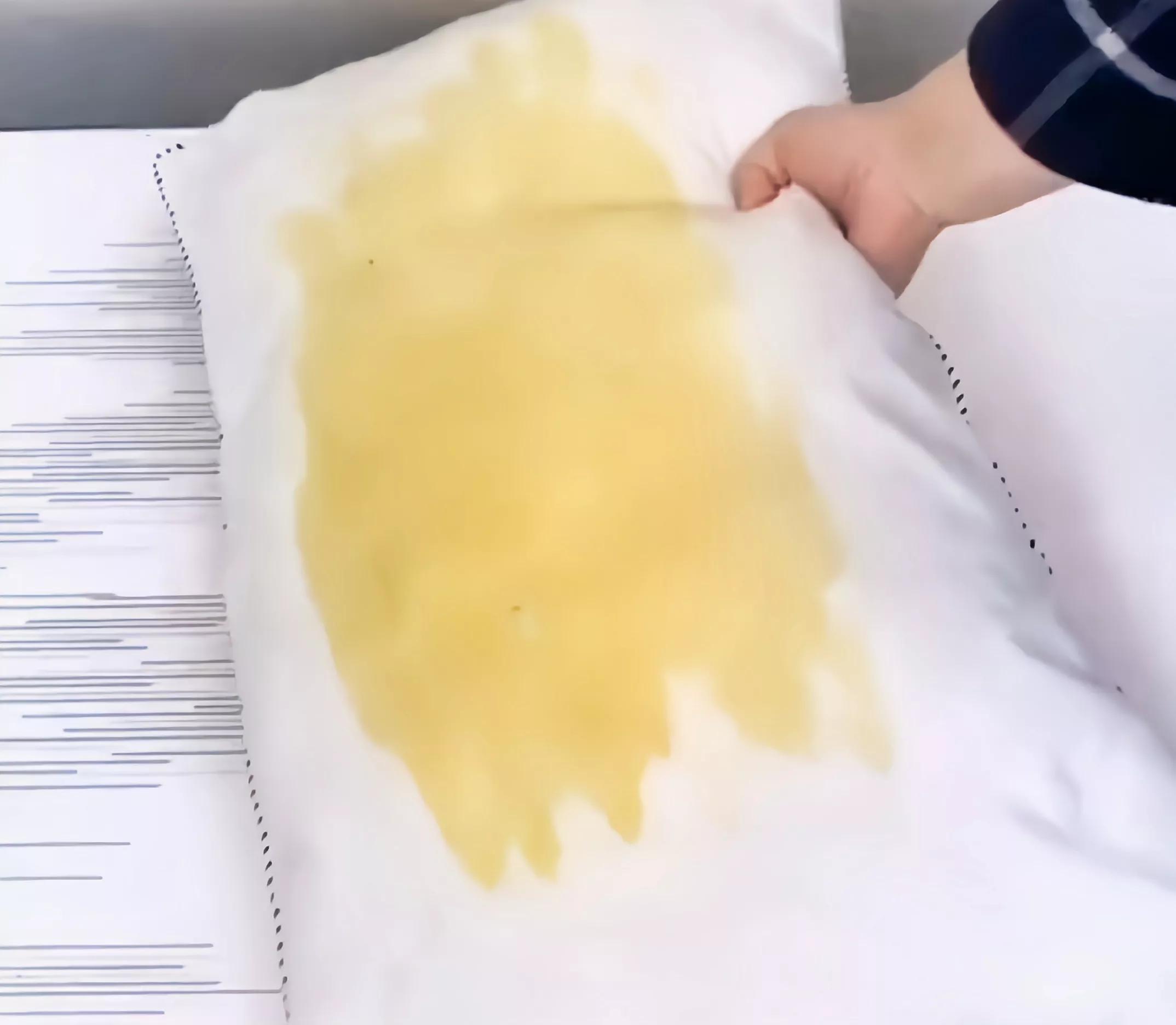 清理毛巾螨虫最有效方法,生活小妙招毛巾除螨