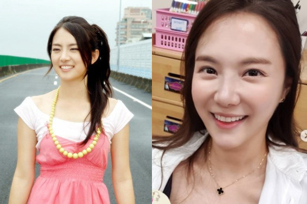 有关整容的韩剧女明星,韩剧女主整容前后对比