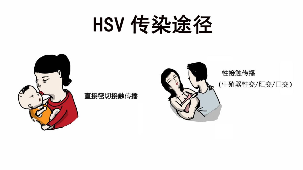 怎么知道自己上火了都有哪些症状,以为是上火其实是癌症