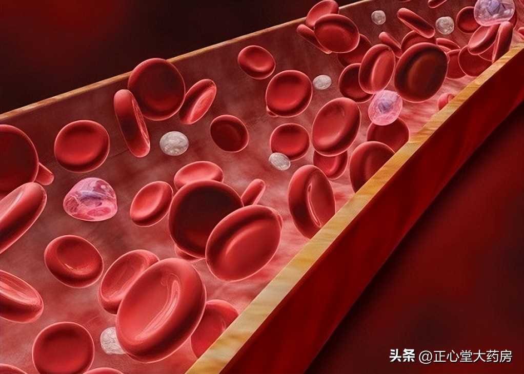 鬼捏青与正常淤青区别,睡醒身上有淤青的秘密