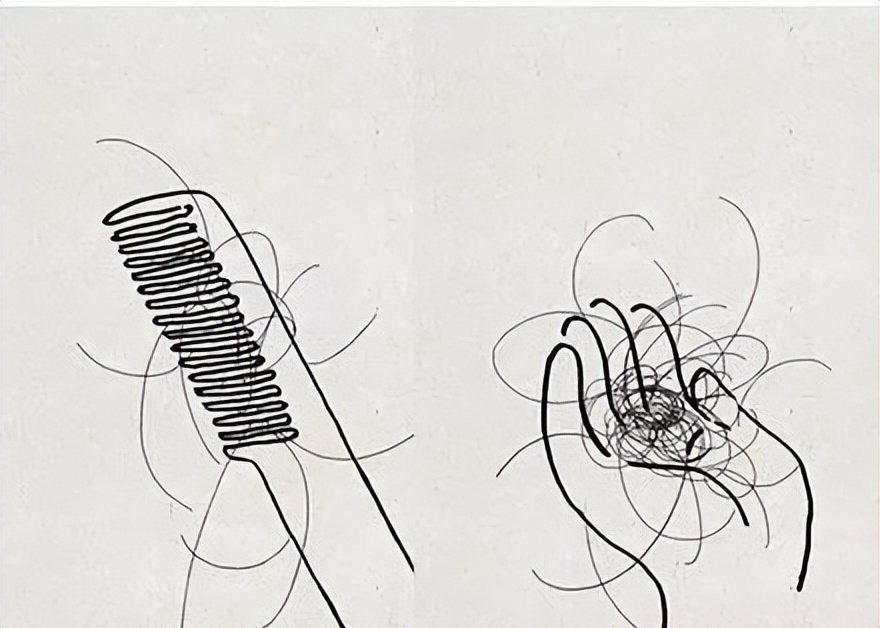 儿童掉头发掉得厉害是什么原因,女生头发掉得厉害是什么原因