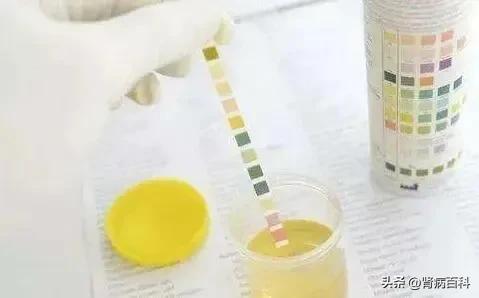 尿蛋白阳性应该多喝水嘛,尿蛋白定量和24小时尿蛋白区别