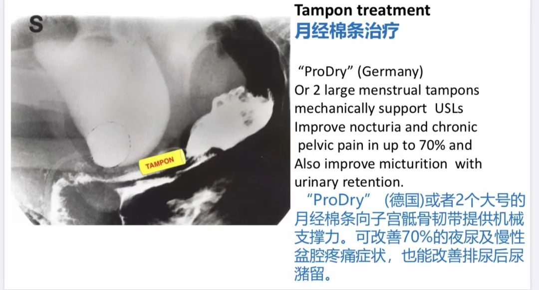 产后排尿不顺畅需要多走走吗,产后排尿困难最佳方法