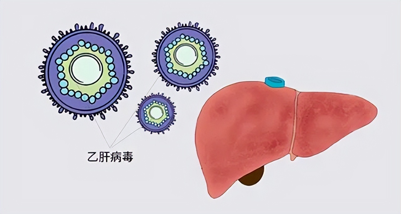 24岁女生确诊肝癌晚期崩溃,29岁护士突发疾病逝世