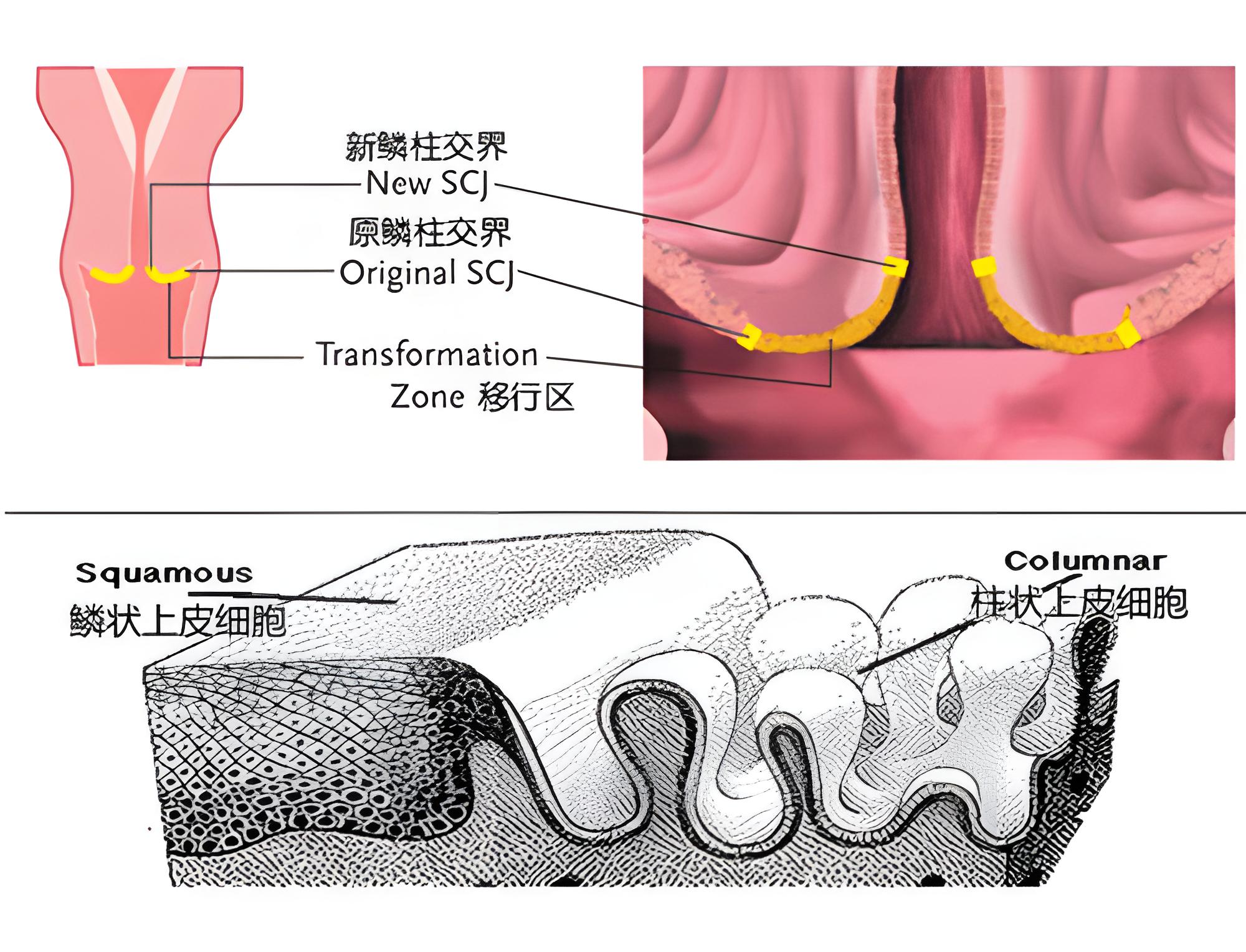 妇科疾病骗局真实事件,女生需要小心的妇科骗局