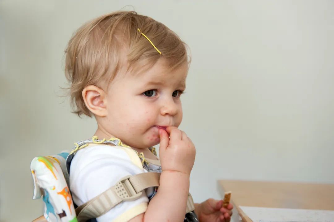 手足口病对应药,手足口病要喝什么口服液