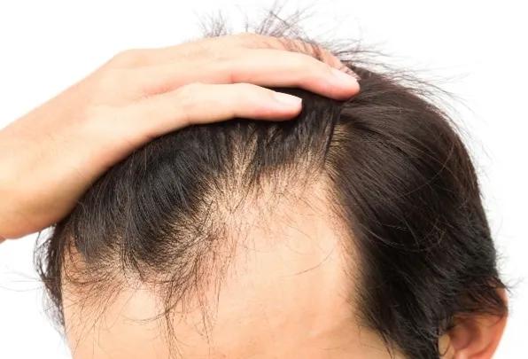 免费黄色网站如何盈利？手机已经植入病毒摄像头拍下你的一举一动