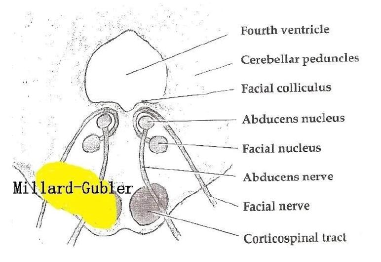 颅脑解剖图简单,颅脑相关解剖生理知识