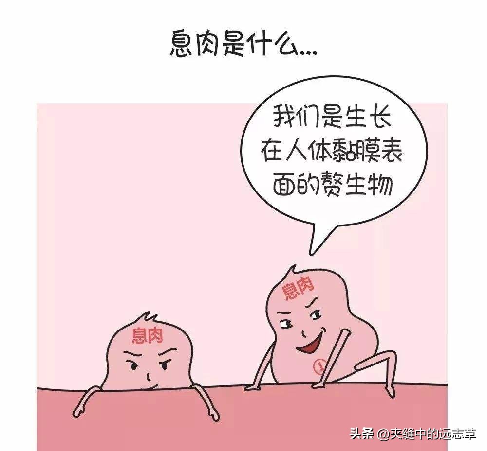 专治息肉的四味药组方,中医四味药消除大部分息肉