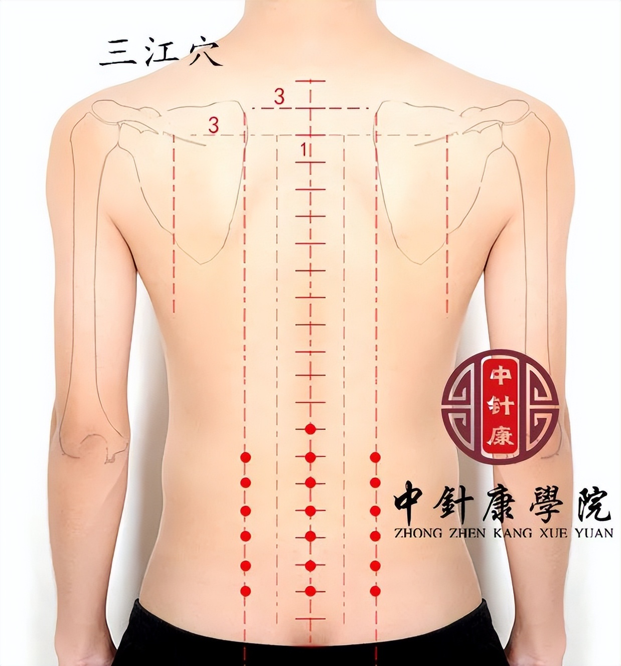 （二）董氏奇穴临床运用体应针法与灸法