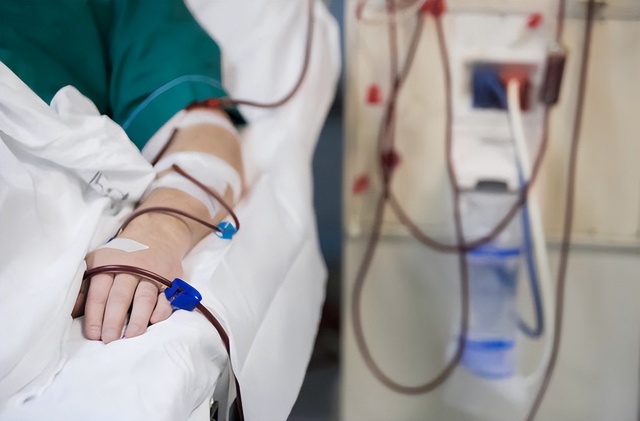 血管造瘘透析,血管人工搭桥