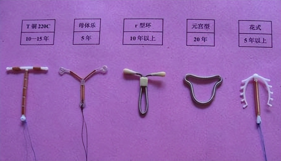 中国第一批“上环”的女性，医生直言：30年了，难逃出这4种结局