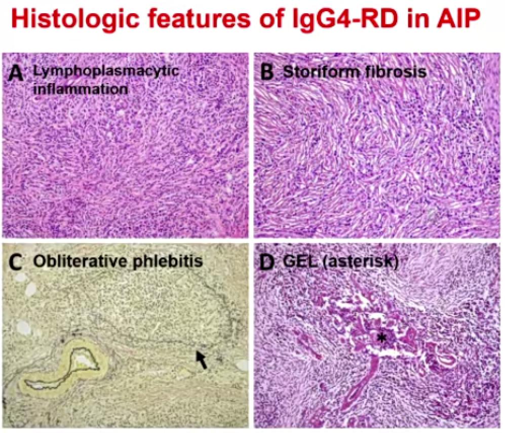 贾继东教授乙肝治愈主要药物,肝病专家贾继东抖音号
