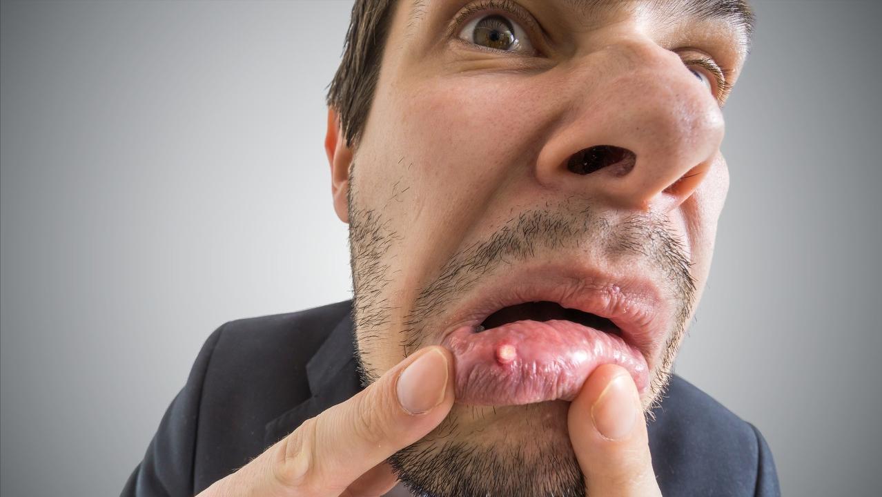 大蒜洋葱降血压还需吃降血压药吗,黄瓜降血压好还是洋葱降血压好