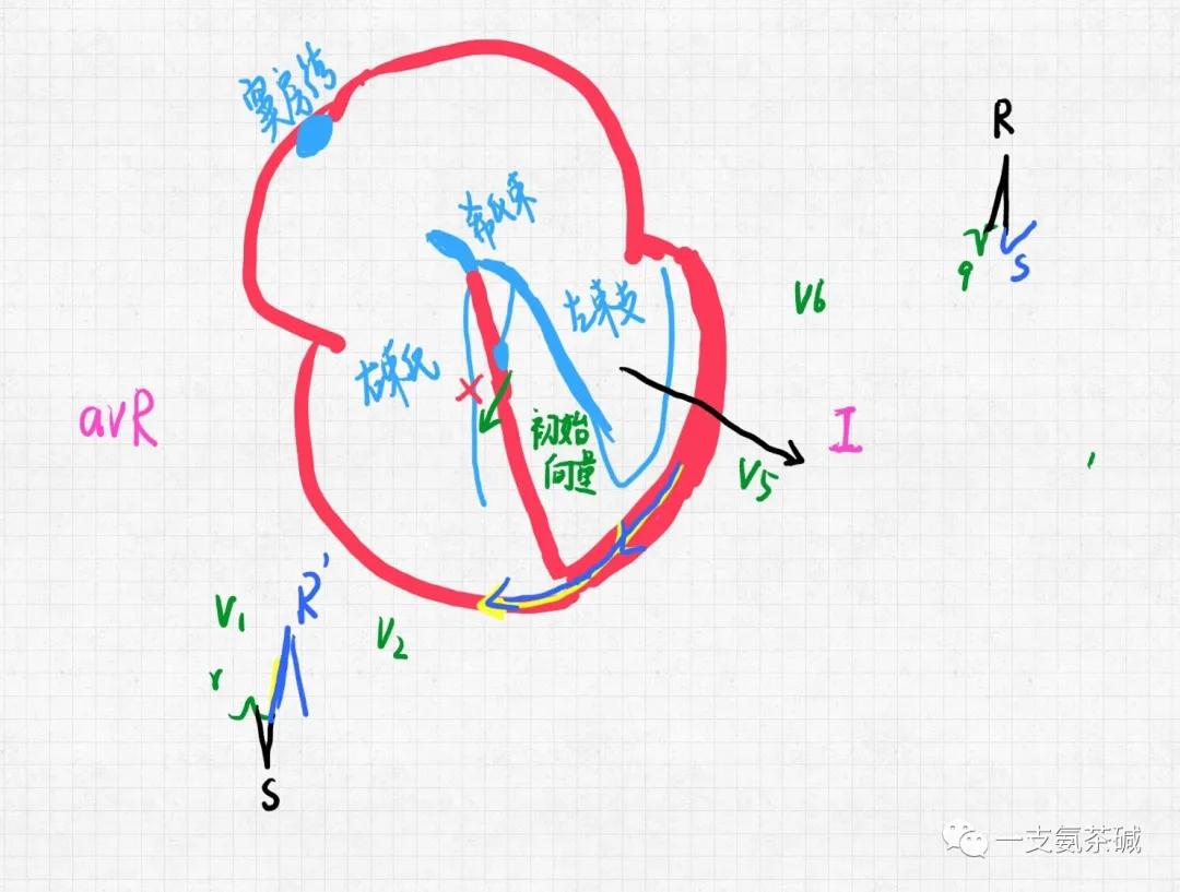 心电图临界异常右束支传导阻滞,心电图十二导和十八导