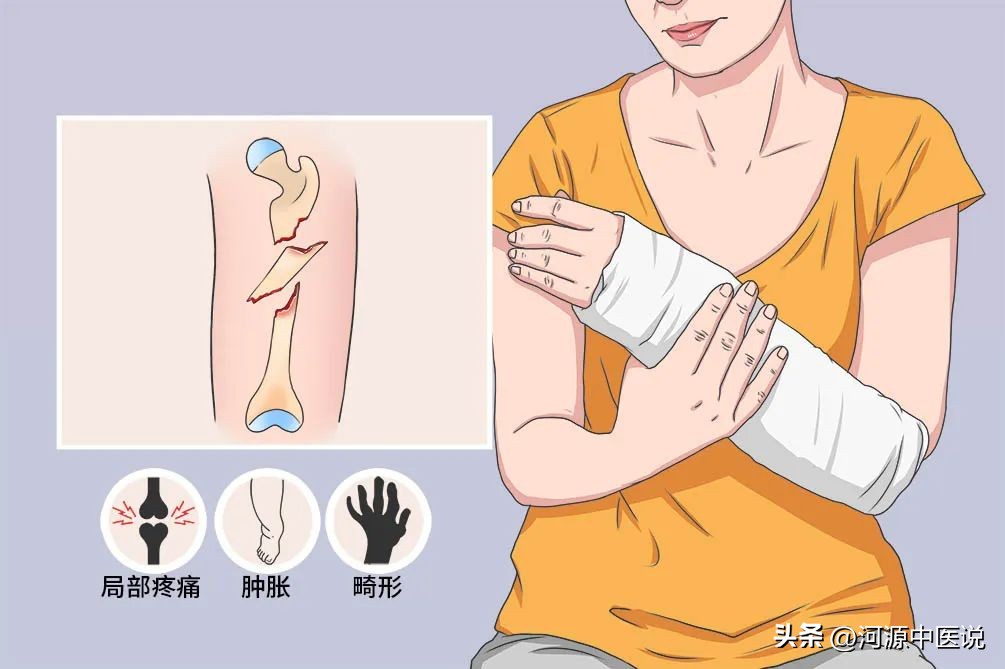 骨折后如何消肿最快方法,骨折手肿了怎样快速消肿