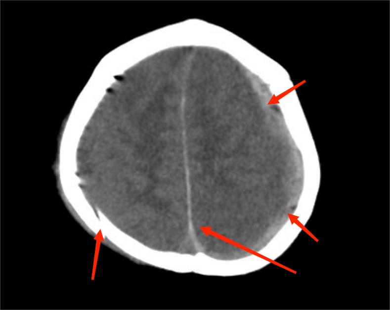 50厘米高,50厘米身高