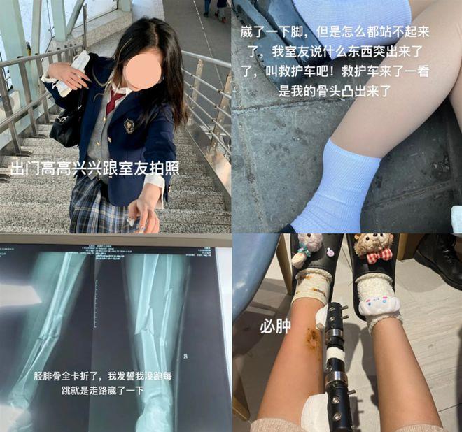 郑州医院接诊脆皮大学生,郑州一院港区医院病人多吗