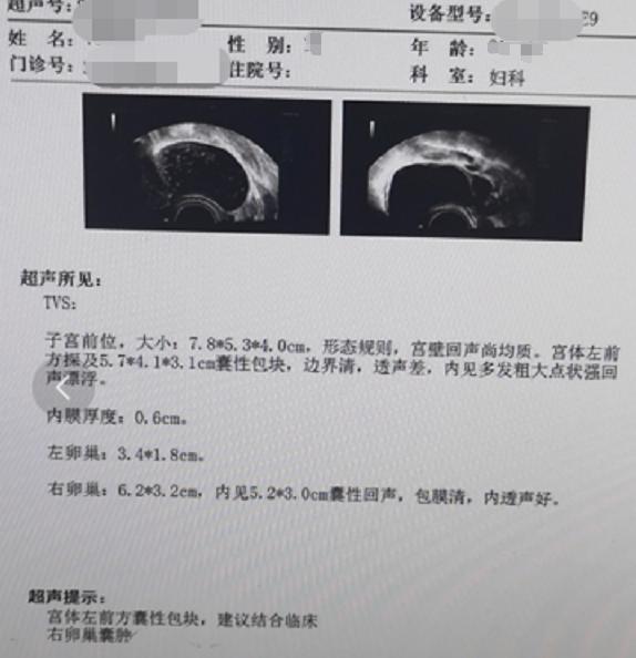 卵巢囊肿的可怕,卵巢囊肿一定要重视