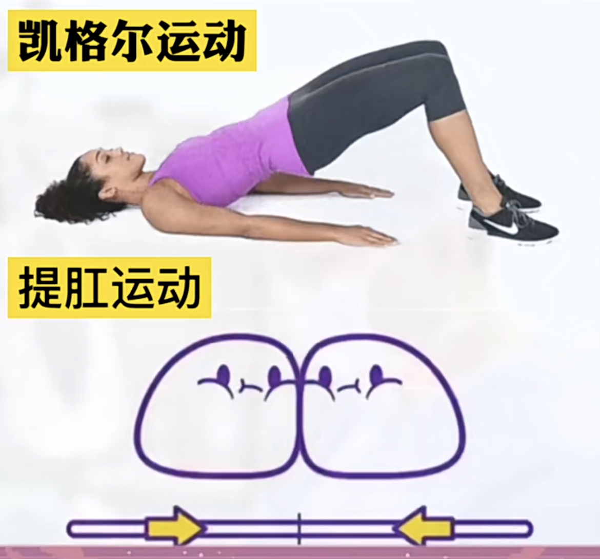 产后漏尿要怎么修复才能好,产后漏尿10个方法修复