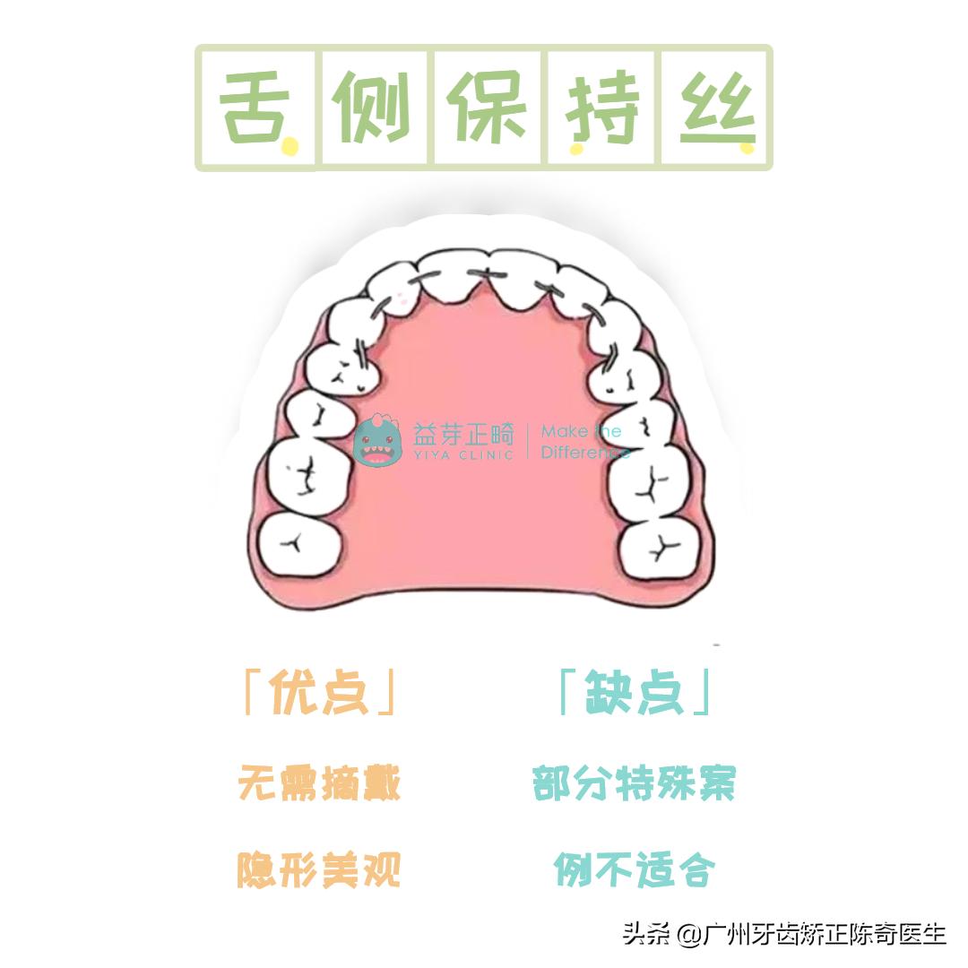 不想戴牙套用什么办法矫正,牙齿正畸后没佩戴保持器反弹