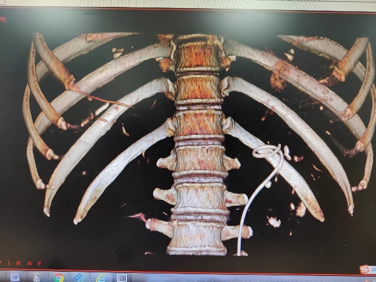 “医”心不凡|黄耀：患者的信任与笑容，都是值得的努力