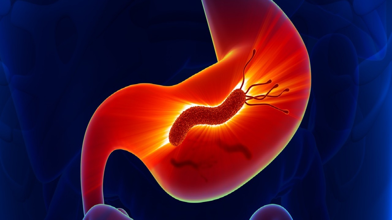 治疗幽门螺杆菌用哪四种药最好,治疗幽门螺杆菌用哪四种药比较好