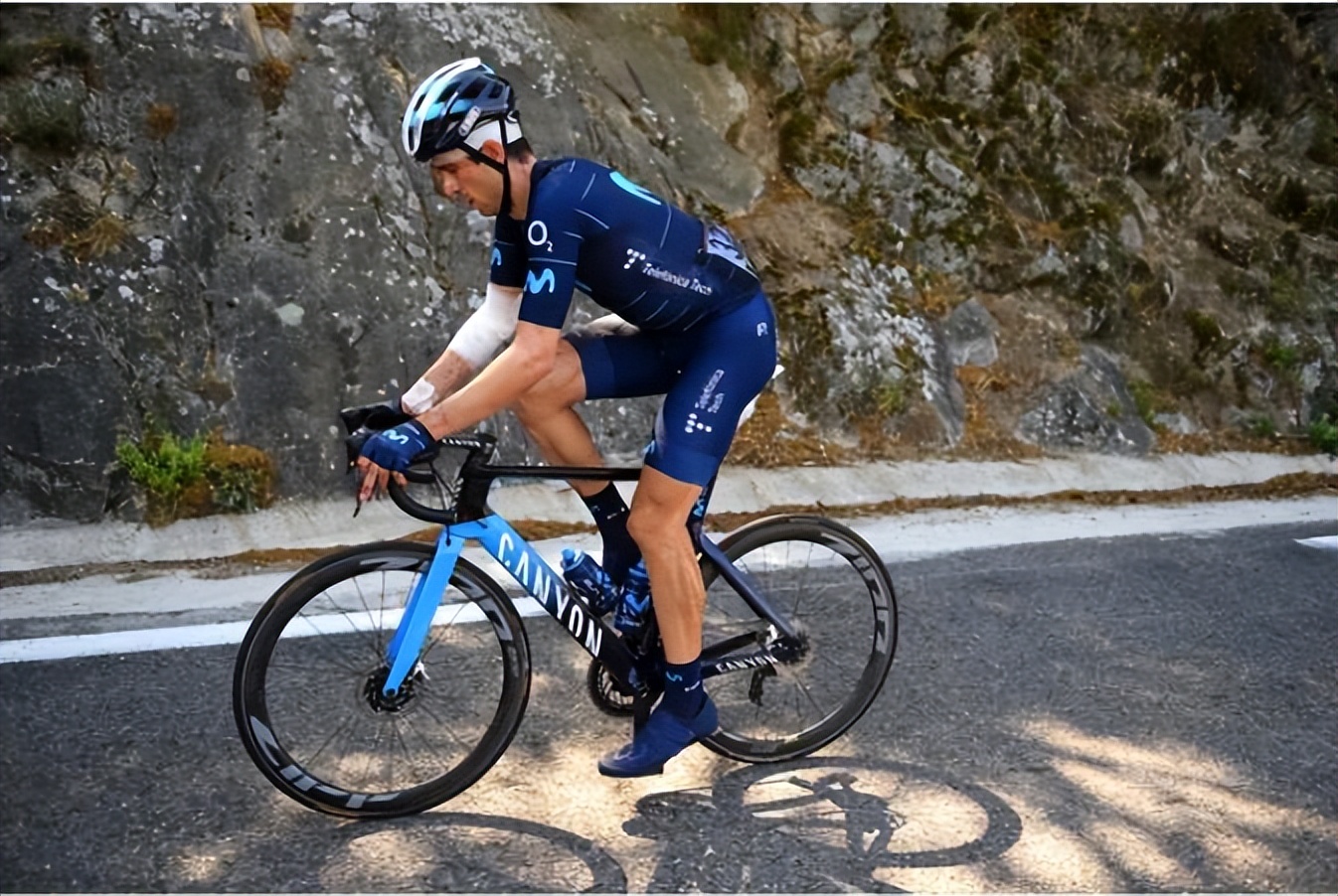 摔车脑震荡,车祸脑震荡恢复的最佳方法