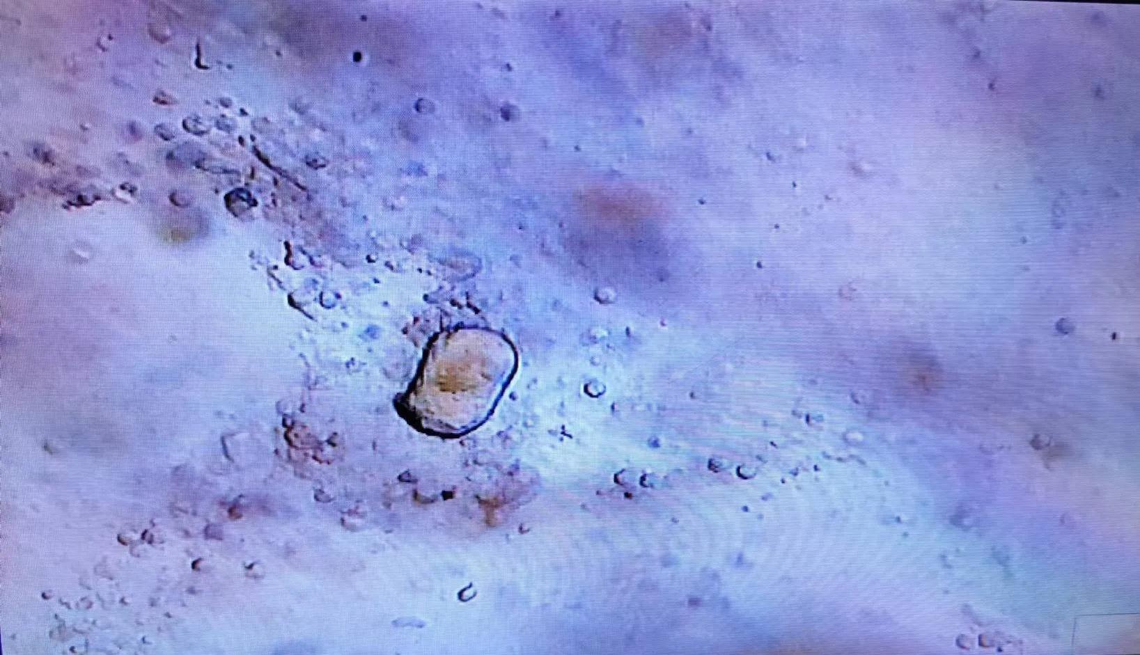 陈医生讲解视频,陈医生讲前列腺养生操