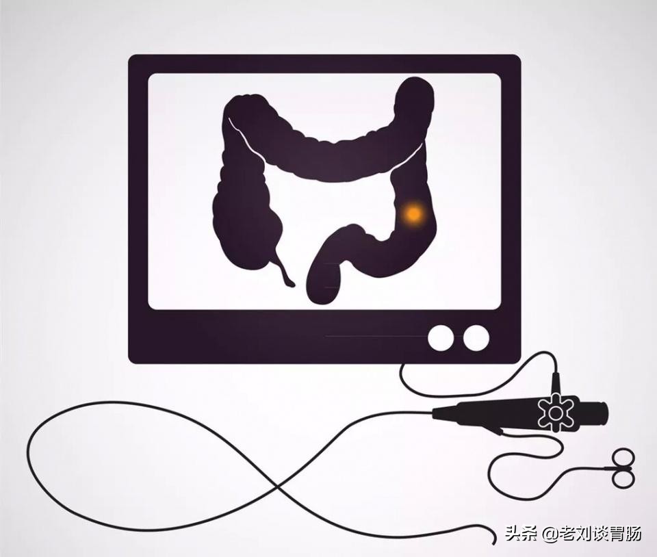 肠镜检查出直肠息肉怎么办,做肠镜发现肠息肉怎么办