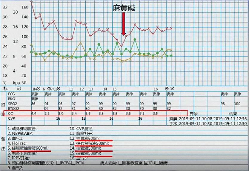李金宝教授:巨大纵隔肿瘤手术的麻醉管理