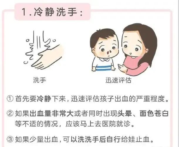 鼻出血射频止血大概需要多久恢复,小孩鼻出血快速止血方法