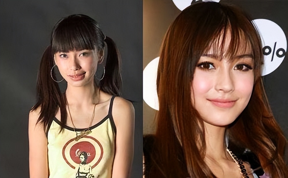 哪些明星整容后遗症越来越严重,整容明星后遗症对比图片