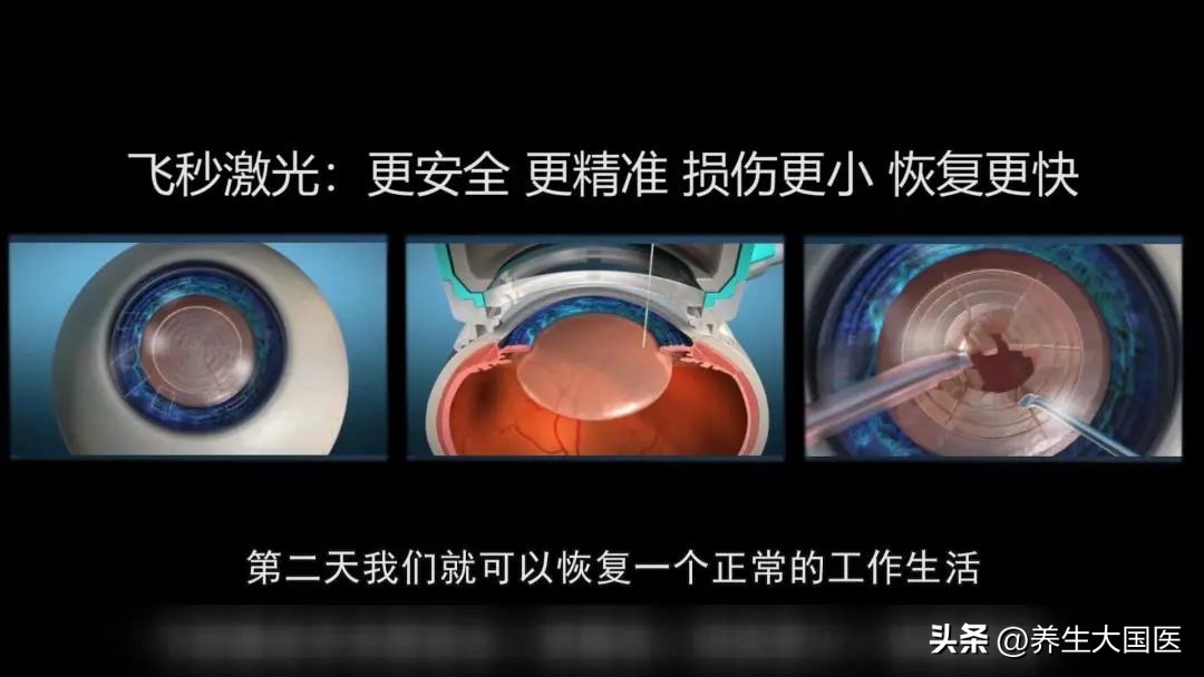 用飞秒激光治疗白内障能治散光吗,白内障飞秒激光近视手术在哪里做