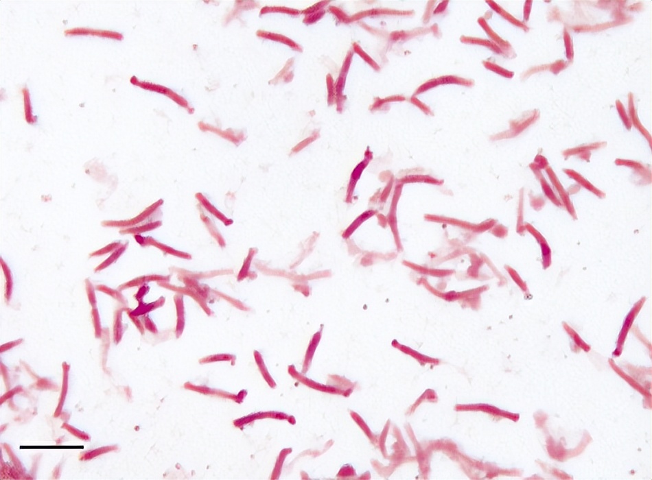 肠道菌群由哪些细菌组成,深度分析肠道细菌