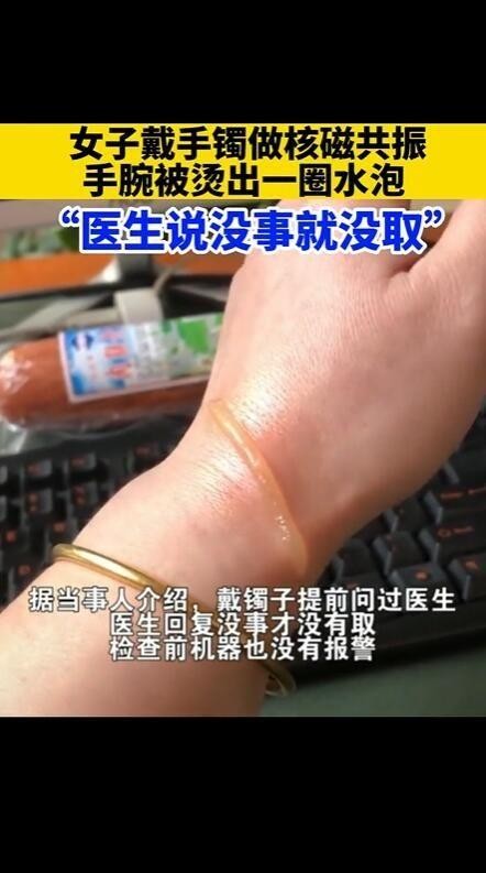 戴手镯做磁共振为什么会烫出水泡,戴金镯子做磁共振会烫伤吗