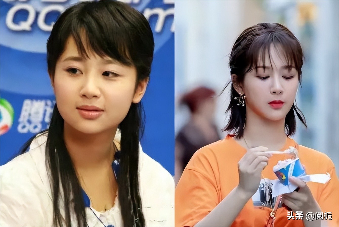 靠换脸逆天改命的六位女星,长得歪瓜裂枣整得美若天仙的明星