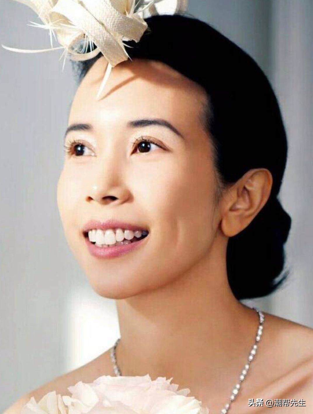 如何辨别唇性嘴凸和齿性嘴凸,嘴凸和嘴龅的区别