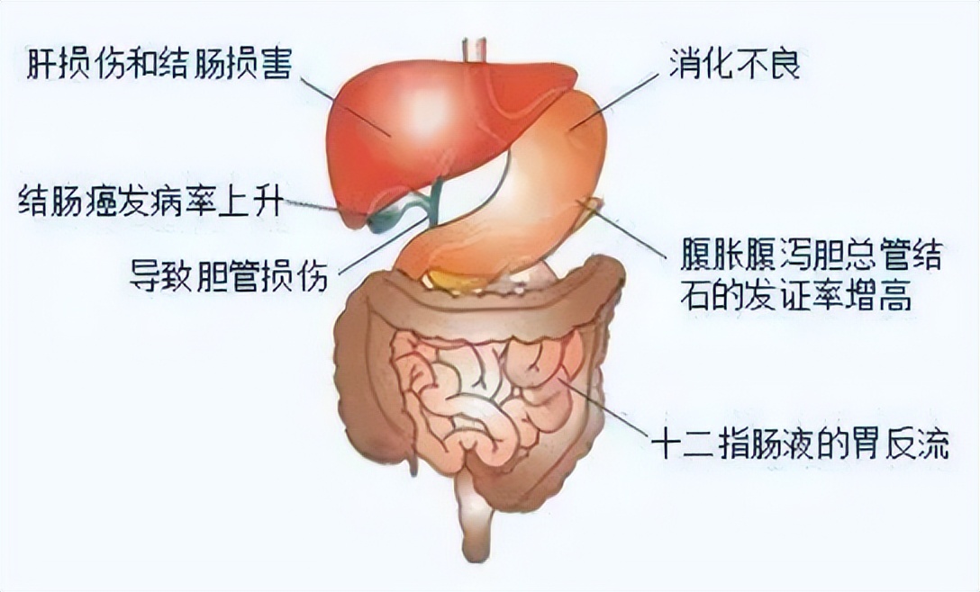 胆囊有罪，真的要杀无赦吗？