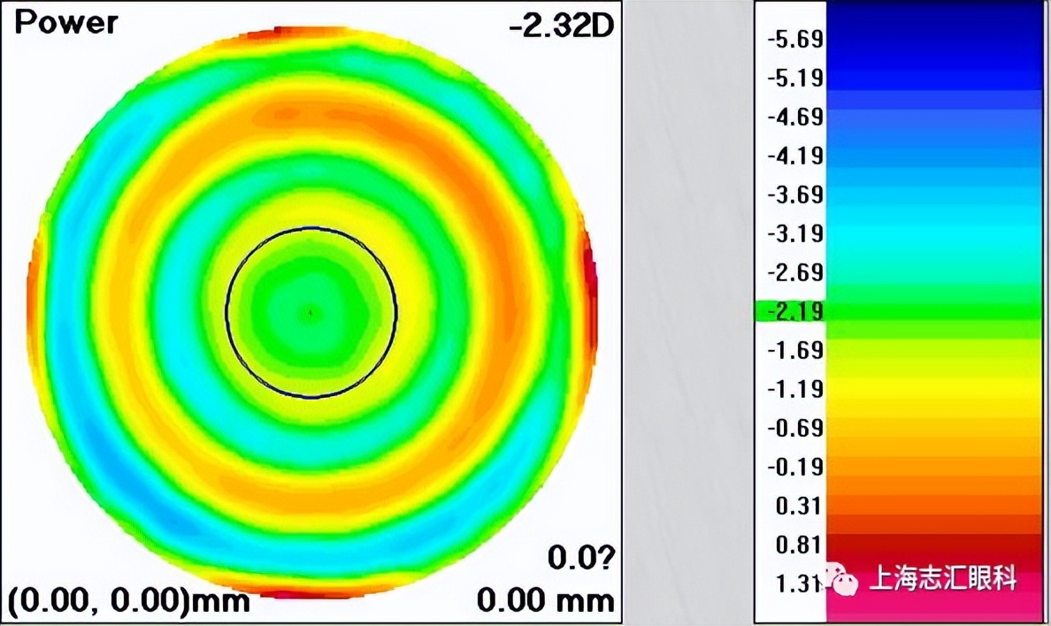 ok镜对所有孩子都有控制效果吗,OK镜和离焦眼镜