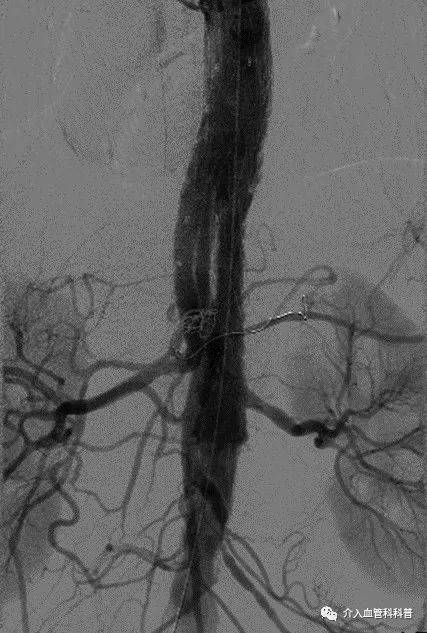南昌二附院血管外科专家,南昌大学第二附属医院周卫